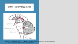 DATOS HISTOPATOLÓGICOS
Jimenez, H. C., Zuñiga, J. V. A., Zuñiga, L. F. A., & Arauz, C. D. (2008). Meningitis Tuberculosa: Un reto clinico y diagnostico.
Redalyc.org. https://www.redalyc.org/articulo.oa?id=426041217011
 