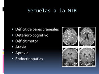 Secuelas a la MTB
 Déficit de pares craneales
 Deterioro cognitivo
 Déficit motor
 Ataxia
 Apraxia
 Endocrinopatias
 
