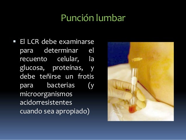 El dolor en la espalda y los aceites medicinales