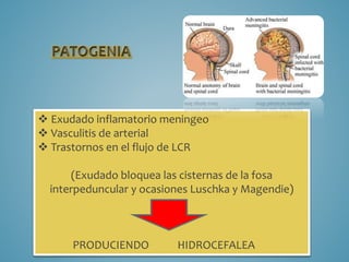  Exudado inflamatorio meningeo
 Vasculitis de arterial
 Trastornos en el flujo de LCR
(Exudado bloquea las cisternas de la fosa
interpeduncular y ocasiones Luschka y Magendie)
PRODUCIENDO HIDROCEFALEA
 