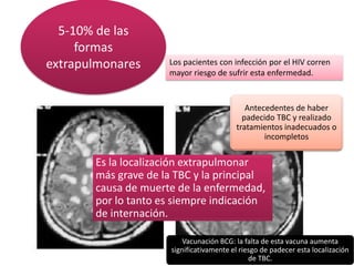 5-10% de las
formas
extrapulmonares

Los pacientes con infección por el HIV corren
mayor riesgo de sufrir esta enfermedad.

Antecedentes de haber
padecido TBC y realizado
tratamientos inadecuados o
incompletos

Es la localización extrapulmonar
más grave de la TBC y la principal
causa de muerte de la enfermedad,
por lo tanto es siempre indicación
de internación.
Vacunación BCG: la falta de esta vacuna aumenta
significativamente el riesgo de padecer esta localización
de TBC.

 