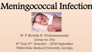 W. P. Rivindu H. Wickramanayake
Group no. 04a
6th Year 2nd Semester – 2020 September
Tbilisi State Medical University, Georgia
Meningococcal Infection
 