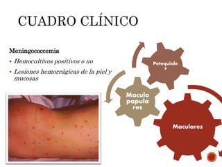 Meningococcemia
 Hemocultivos positivos o no
 Lesiones hemorrágicas de la piel y
mucosas
Maculares
Maculo
papula
res
Petequiale
s
 