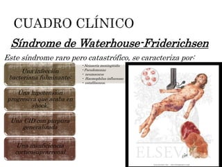 •Neisseria meningitidis
•Pseudomonas
• neumococos
• Haemophilus influenzae
• estafilococos.
Una infección
bacteriana fulminante:
Una hipotensión
progresiva que acaba en
shock.
Una CID con purpura
generalizada
Una insuficiencia
corticosuprarrenal
Síndrome de Waterhouse-Friderichsen
Este síndrome raro pero catastrófico, se caracteriza por:
 