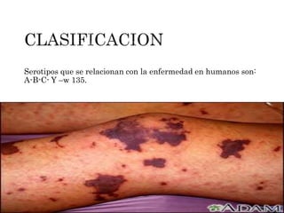 Serotipos que se relacionan con la enfermedad en humanos son:
A-B-C- Y –w 135.
 