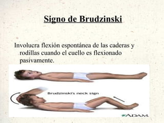 Signo de Brudzinski

Involucra flexión espontánea de las caderas y
  rodillas cuando el cuello es flexionado
  pasivamente.
 