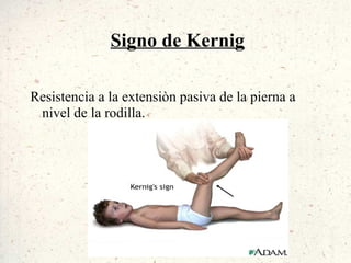 Signo de Kernig

Resistencia a la extensiòn pasiva de la pierna a
 nivel de la rodilla.
 