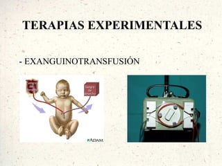 TERAPIAS EXPERIMENTALES

- EXANGUINOTRANSFUSIÓN
 