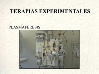 TERAPIAS EXPERIMENTALES

PLASMAFÉRESIS
 