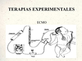 TERAPIAS EXPERIMENTALES

         ECMO
 