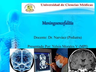 Meningoencefalitis 
Docente: Dr. Narváez (Pediatra) 
Presentado Por: Yelsin Morales V (MPI) 
 