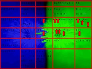 N O R M A L V I R A L B A C T E R I A N A T B
A S P E C T O A g u a d e
r o c a
A g u a d e
r o c a
T u r b i o -
p u r u l e n t o
C l a r o o
a m a r i l l o
P R O T E Í N A S 1 5 a
4 5 m g %
1 0 0 2 0 0 - 3 0 0 9 0 0
C É L U L A S 0 - 7 1 0 0 7 0 0 -
1 0 0 0
4 0 0
T I P O S
C E L U L A R E S
l i n f o c i t o s P M N L i n f o c i t o s
G L U C O S A ½ a 2 / 3
d e 3 r a
p t e 6 0 -
4 0 m g
N o r m a l o
d i s m i n u i d o
 