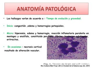 •     Los hallazgos varían de acuerdo a : Tiempo de evolución y gravedad.


•     Inicio :congestión ,edema y hemorragias petequiales.


•     Micro: hiperemia, edema y hemorragia, reacción inflamatoria purulenta en
      meninges y encéfalo, constituido por PMN, fibrina, bacterias aglutinadas,
      eritrocitos.


•      En ocasiones : necrosis cortical
    resultado de alteración vascular.




                                        Rev Cubana Med Trop v.60 n.3 Ciudad de la Habana sep.-dic. 2010
 
