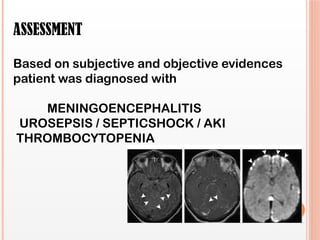 ASSESSMENT
Based on subjective and objective evidences
patient was diagnosed with
MENINGOENCEPHALITIS
UROSEPSIS / SEPTICSHOCK / AKI
THROMBOCYTOPENIA
 
