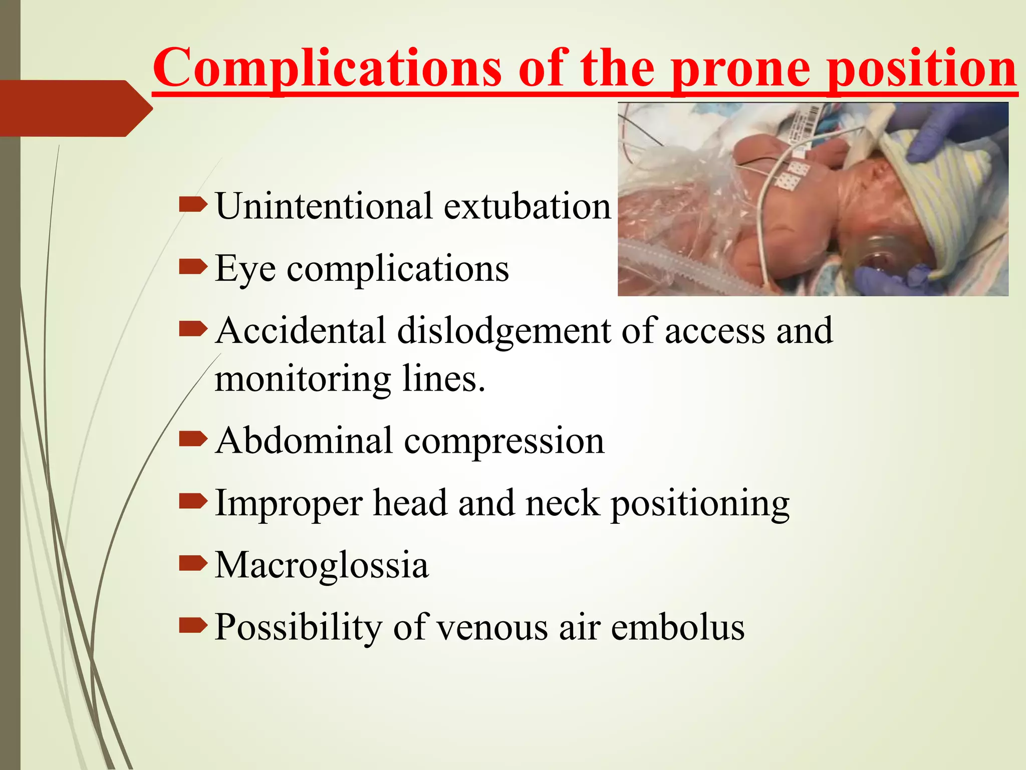 anaesthetic management of Meningomyelocele and its Surgical excision | PPTX