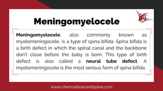 Meningomyelocele | PDF
