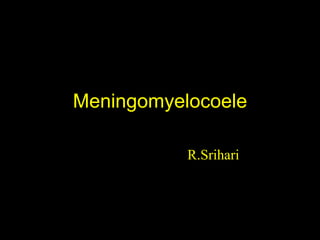 Meningomyelocoele
R.Srihari
 