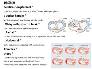 Meniscal Injuries fast review and treatment | PPTX