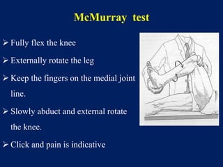 Mcmurray Testing Meniscal Injuries | PPTX
