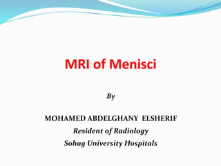 MRI of Menisci
By
MOHAMED ABDELGHANY ELSHERIF
Resident of Radiology
Sohag University Hospitals
 