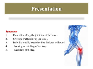 Presentation 
Symptoms 
1. Pain, often along the joint line of the knee . 
2. Swelling (“effusion” in the joint). 
3. Inability to fully extend or flex the knee without discomfort . 
4. Locking or catching of the knee. 
5. Weakness of the leg. 
 