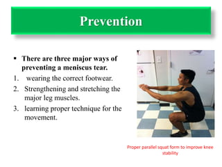Prevention 
 There are three major ways of 
preventing a meniscus tear. 
1. wearing the correct footwear. 
2. Strengthening and stretching the 
major leg muscles. 
3. learning proper technique for the 
movement. 
Proper parallel squat form to improve knee 
stability 
 