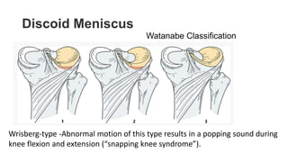 Meniscal injury | PPTX