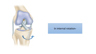 In internal rotation-
 