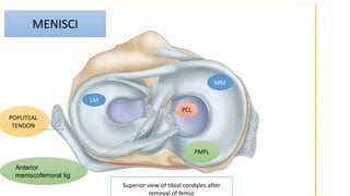Superior view of tibial condyles after
removal of femur
MENISCI
POPLITEAL
TENDON
Anterior
meniscofemoral lig
PMFL
PCL
MM
LM
 
