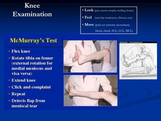 Knee 
Examination 
• Look (gait, muscle atrophy, swelling, bruise) 
• Feel (joint line tenderness, effusion, cyst) 
• Move (pain on extreme movement, 
block, check ACL, LCL, MCL) 
 
