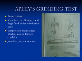  Prone position 
 Knee flexed to 90 degree and 
thigh fixed to the examination 
table 
 compression and rotating 
tibial plateau on femoral 
condyles 
 Joint line pain on rotation 
 