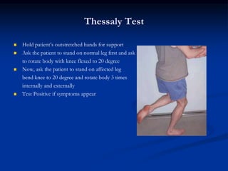 Thessaly Test 
 Hold patient’s outstretched hands for support 
 Ask the patient to stand on normal leg first and ask 
to rotate body with knee flexed to 20 degree 
 Now, ask the patient to stand on affected leg 
bend knee to 20 degree and rotate body 3 times 
internally and externally 
 Test Positive if symptoms appear 
 