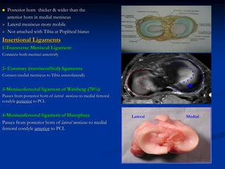  Posterior horn thicker & wider than the 
anterior horn in medial meniscus 
 Lateral meniscus more mobile 
 Not attached with Tibia at Popliteal hiatus 
Insertional Ligaments 
1-Transverse Meniscal Ligament 
Connects both menisci anteriorly 
2- Coronary (meniscotibial) ligaments 
Connect medial meniscus to Tibia anterolaterally 
3-Meniscofemoral ligament of Wrisberg (70%) 
Passes from posterior horn of lateral meniscus to medial femoral 
condyle posterior to PCL 
4-Meniscofemoral ligament of Humphrey 
Passes from posterior horn of lateral meniscus to medial 
femoral condyle anterior to PCL 
Lateral Medial 
 