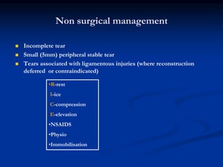 Non surgical management 
 Incomplete tear 
 Small (5mm) peripheral stable tear 
 Tears associated with ligamentous injuries (where reconstruction 
deferred or contraindicated) 
•R-rest 
I-ice 
C-compression 
E-elevation 
•NSAIDS 
•Physio 
•Immobilisation 
 