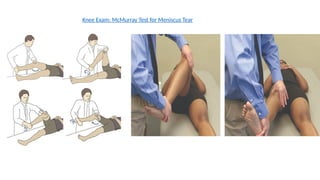Mcmurray Testing KNEE MENISCAL TEARS AND INJURIES TRATMENT.pptx