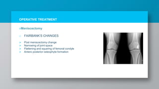 OPERATIVE TREATMENT
»Meniscectomy
o FAIRBANK’S CHANGES
 Post meniscectomy change
 Narrowing of joint space
 Flattening and squaring of femoral condyle
 Antero posterior osteophyte formation
 