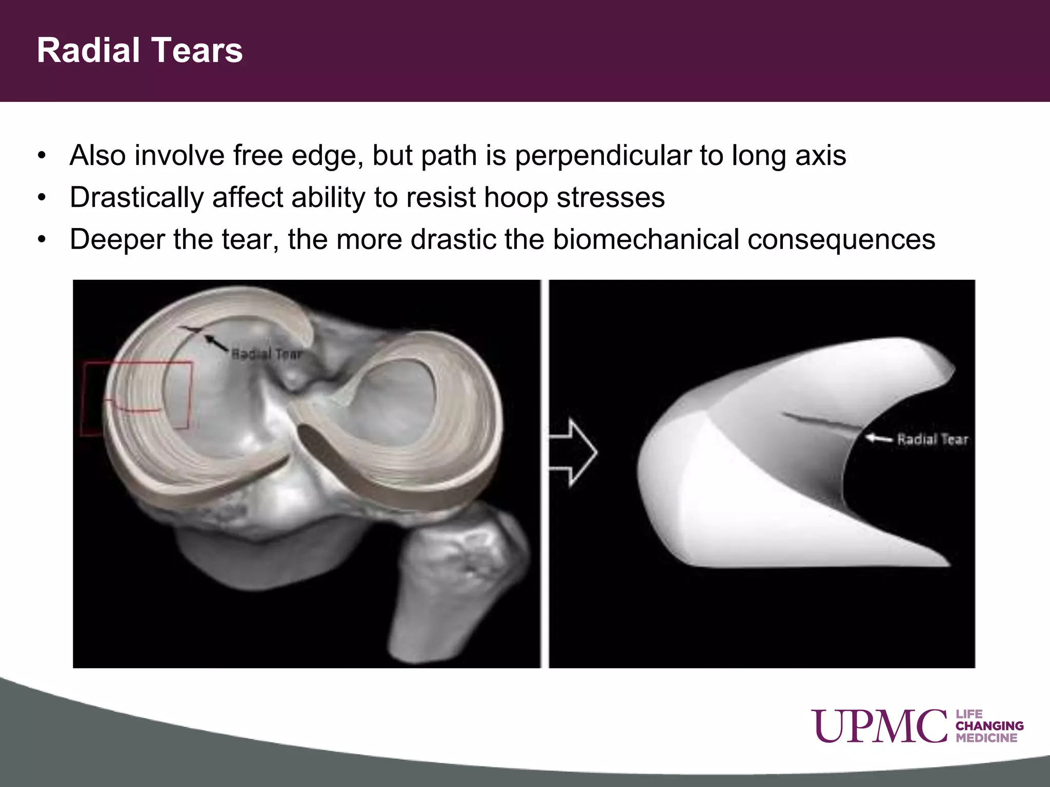 meniscus-injuries.pptx | Death, Injury, or Military Conflict ...