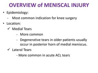 OVERVIEW of MENISCAL INJURY
• Epidemiology:
- Most common indication for knee surgery
• Location:
 Medial Tears
- More common
- Degenerative tears in older patients usually
occur in posterior horn of medial meniscus.
 Lateral Tears
- More common in acute ACL tears
 