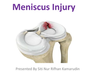 Meniscus Injury
Presented By Siti Nur Rifhan Kamarudin
 