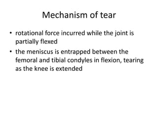 Mechanism of tear
• rotational force incurred while the joint is
partially flexed
• the meniscus is entrapped between the
femoral and tibial condyles in flexion, tearing
as the knee is extended
 