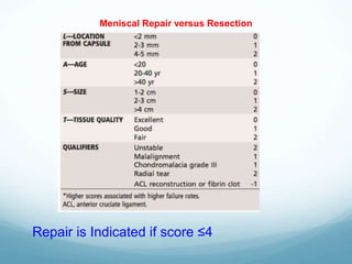 Meniscal Repair versus Resection
Repair is Indicated if score ≤4
 