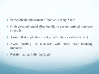 ● Perpendicular placement of implants every 5 mm
● Grab circumferential fiber bundle to ensure optimal purchase
strength
● Ensure that implants are not proud (intra-or extraarticular)
● Avoid stuffing the meniscus with stress riser inducing
implants
● Rehabilitation: Individualized
 