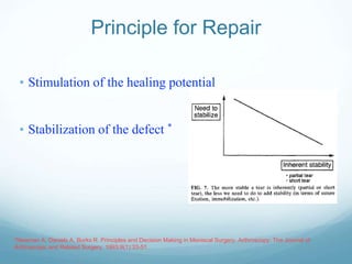 Principle for Repair
• Stimulation of the healing potential
• Stabilization of the defect *
*Newman A, Daniels A, Burks R. Principles and Decision Making in Meniscal Surgery. Arthroscopy: The Journal of
Arthroscopic and Related Surgery. 1993;9(1):33-51.
 