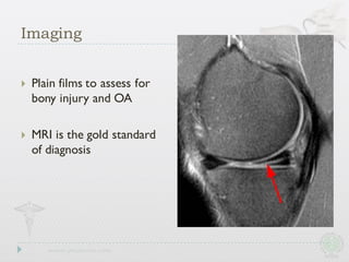 } Plain films to assess for
bony injury and OA
} MRI is the gold standard
of diagnosis
Imaging
 