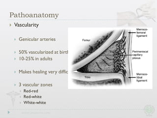 } Vascularity
} Genicular arteries
} 50% vascularized at birth
} 10-25% in adults
} Makes healing very difficult
} 3 vascular zones
} Red-red
} Red-white
} White-white
Pathoanatomy
 