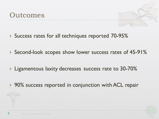 Outcomes
} Success rates for all techniques reported 70-95%
} Second-look scopes show lower success rates of 45-91%
} Ligamentous laxity decreases success rate to 30-70%
} 90% success reported in conjunction with ACL repair
 