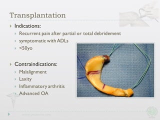 Transplantation
} Indications:
} Recurrent pain after partial or total debridement
} symptomatic with ADLs
} <50yo
} Contraindications:
} Malalignment
} Laxity
} Inflammatory arthritis
} Advanced OA
 