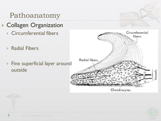 } Collagen Organization
} Circumferential fibers
} Radial Fibers
} Fine superficial layer around
outside
Pathoanatomy
 