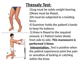 MENISCUS 2745236382575687647634TEAR[1].pptx