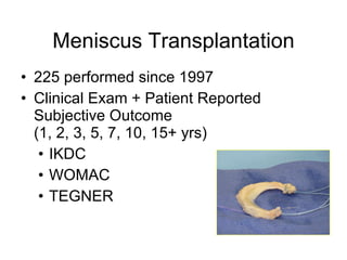 Meniscus Transplantation 225 performed since 1997 Clinical Exam + Patient Reported Subjective Outcome  (1, 2, 3, 5, 7, 10, 15+ yrs) IKDC WOMAC TEGNER 